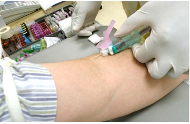 Iniciativa Aventurarse Nutrición Procedimiento para la extracción de sangre por vía venosa - Probas  diagnósticas